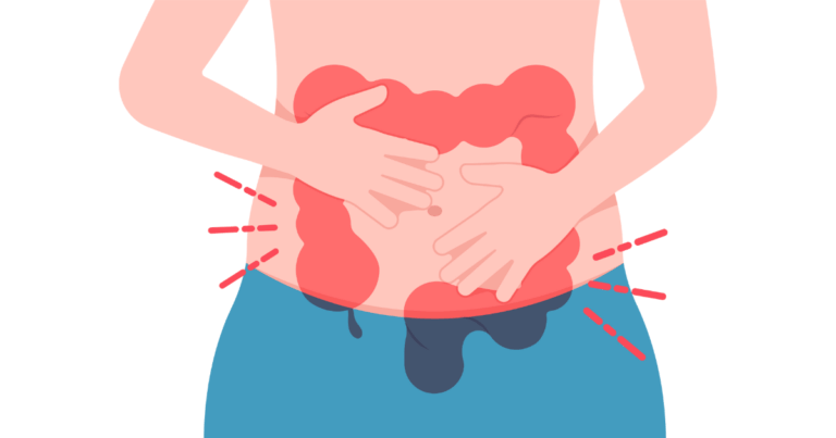 ダイエット中の便秘によるお腹の張りを表したイラスト